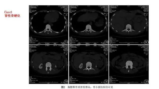 【PPT】常见骨骼病变的诊断与鉴别诊断