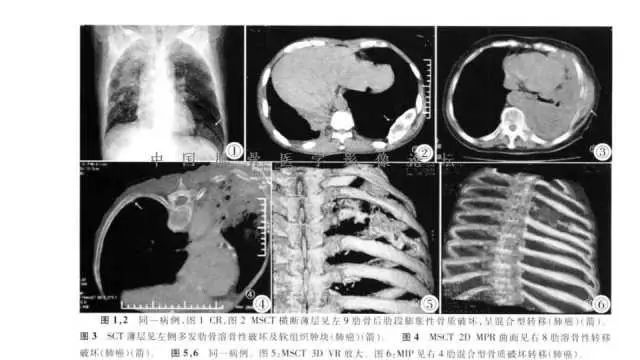 【PPT】常见骨骼病变的诊断与鉴别诊断