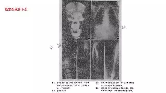 【PPT】常见骨骼病变的诊断与鉴别诊断