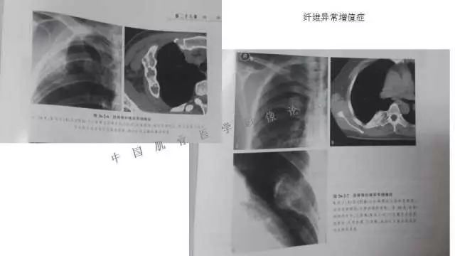 【PPT】常见骨骼病变的诊断与鉴别诊断