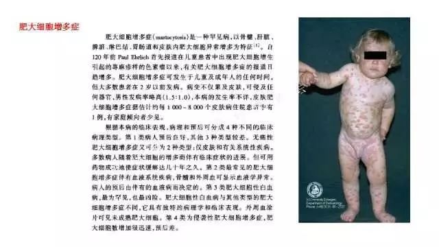 【PPT】常见骨骼病变的诊断与鉴别诊断