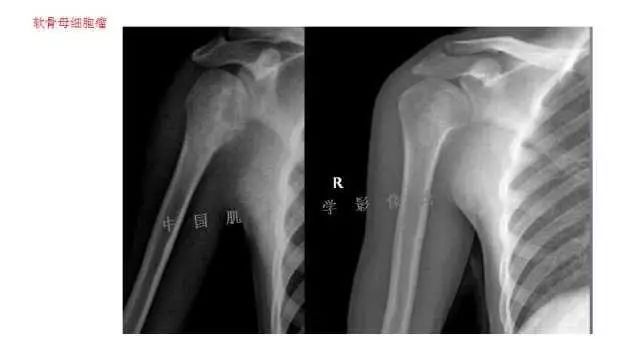 【PPT】常见骨骼病变的诊断与鉴别诊断