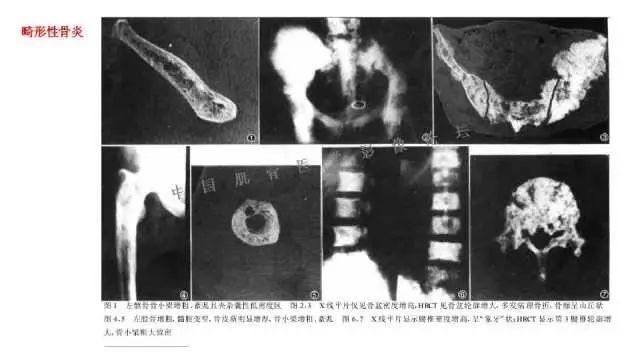 【PPT】常见骨骼病变的诊断与鉴别诊断