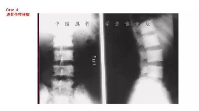【PPT】常见骨骼病变的诊断与鉴别诊断