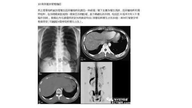 【PPT】常见骨骼病变的诊断与鉴别诊断