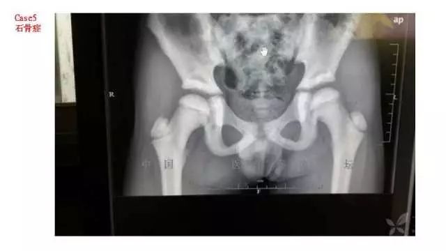 【PPT】常见骨骼病变的诊断与鉴别诊断