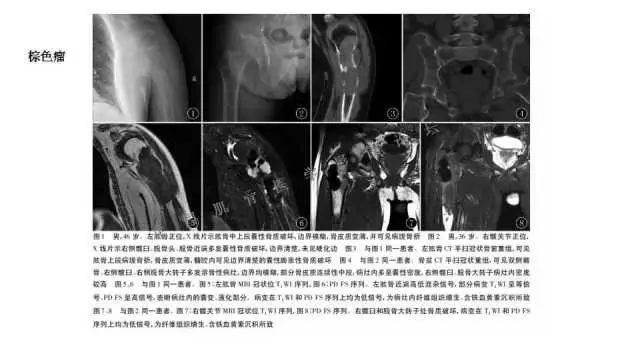 【PPT】常见骨骼病变的诊断与鉴别诊断