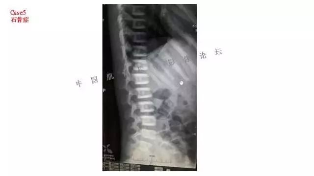 【PPT】常见骨骼病变的诊断与鉴别诊断