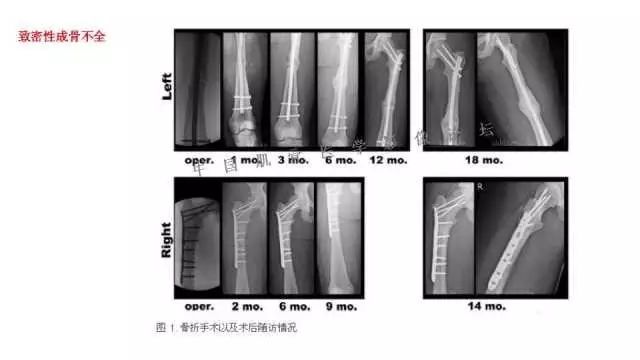 【PPT】常见骨骼病变的诊断与鉴别诊断