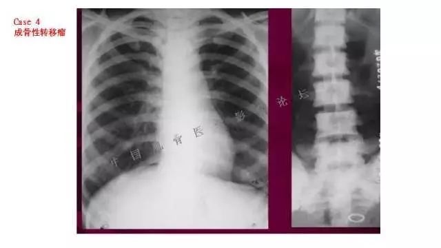 【PPT】常见骨骼病变的诊断与鉴别诊断