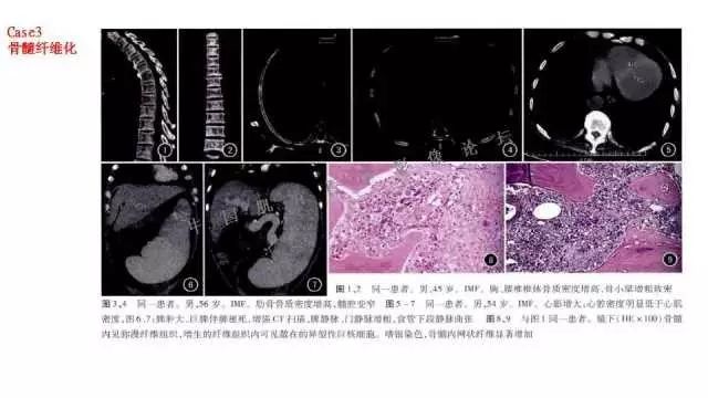 【PPT】常见骨骼病变的诊断与鉴别诊断
