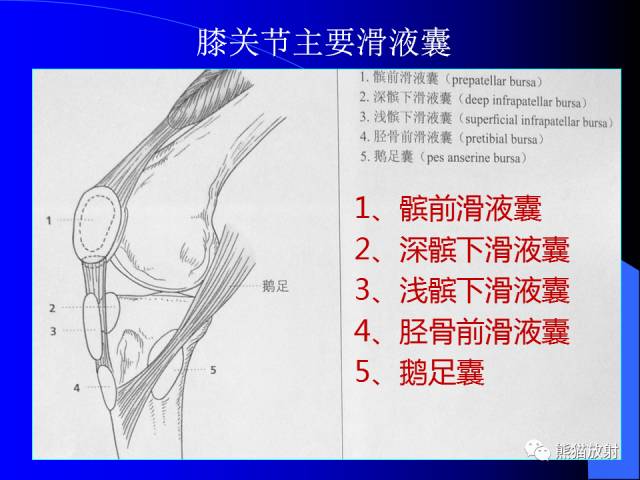 【PPT】膝关节周围囊肿MRI 【PPT】膝关节周围囊肿MRI