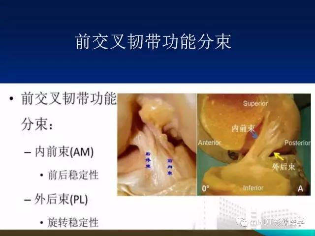 【PPT】前交叉韧带重建术后的MRI评价