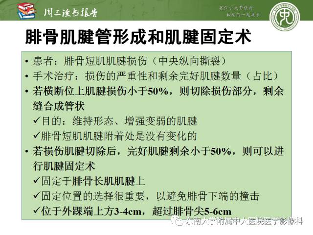 【PPT】踝及足术后CT和MR成像