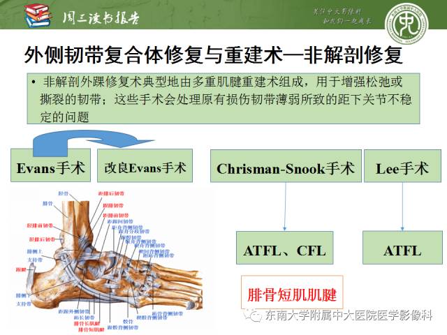 【PPT】踝及足术后CT和MR成像