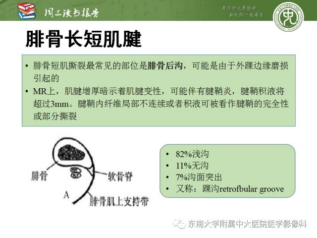 【PPT】踝及足术后CT和MR成像