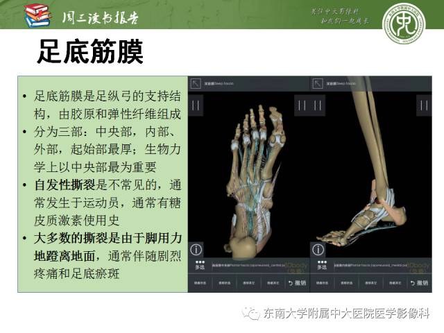 【PPT】踝及足术后CT和MR成像