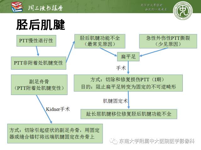 【PPT】踝及足术后CT和MR成像