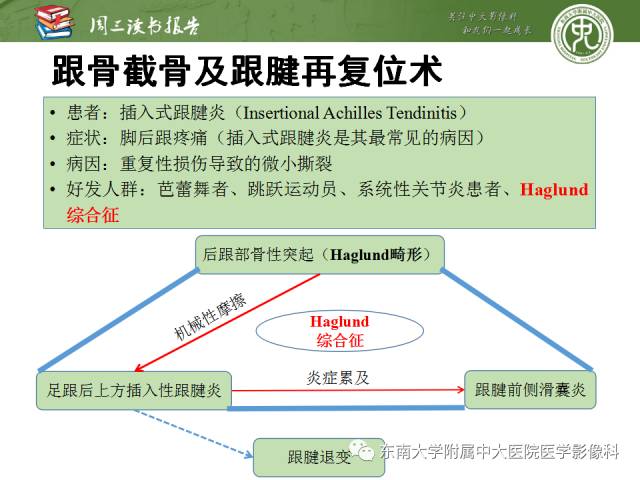 【PPT】踝及足术后CT和MR成像