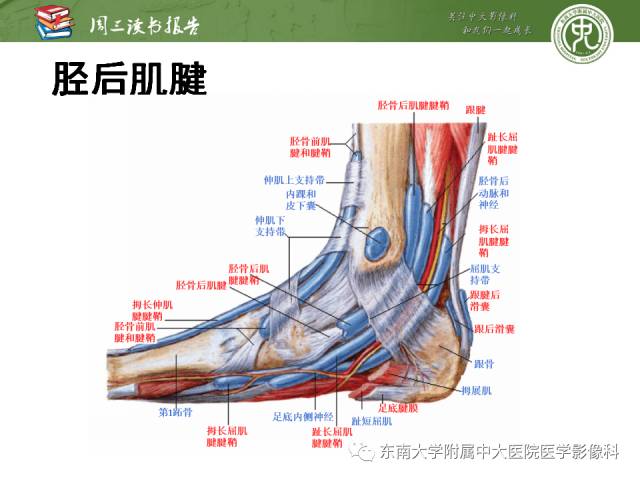 【PPT】踝及足术后CT和MR成像
