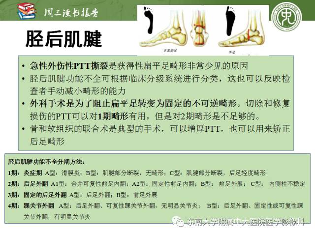 【PPT】踝及足术后CT和MR成像