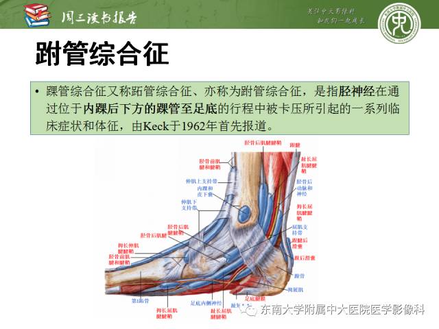 【PPT】踝及足术后CT和MR成像