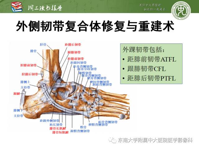 【PPT】踝及足术后CT和MR成像