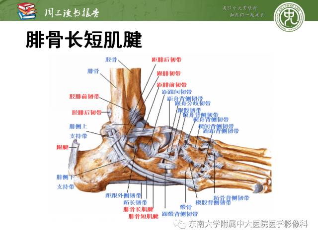 【PPT】踝及足术后CT和MR成像