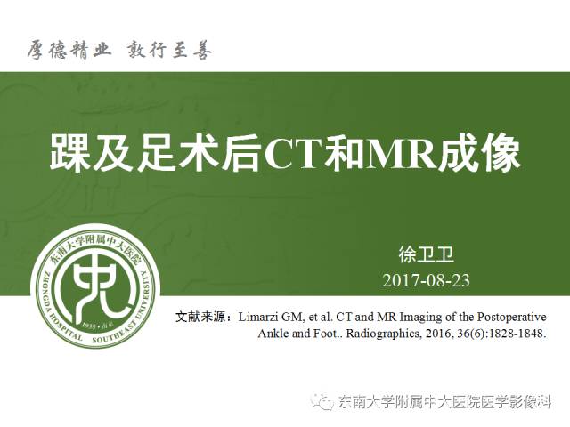 【PPT】踝及足术后CT和MR成像