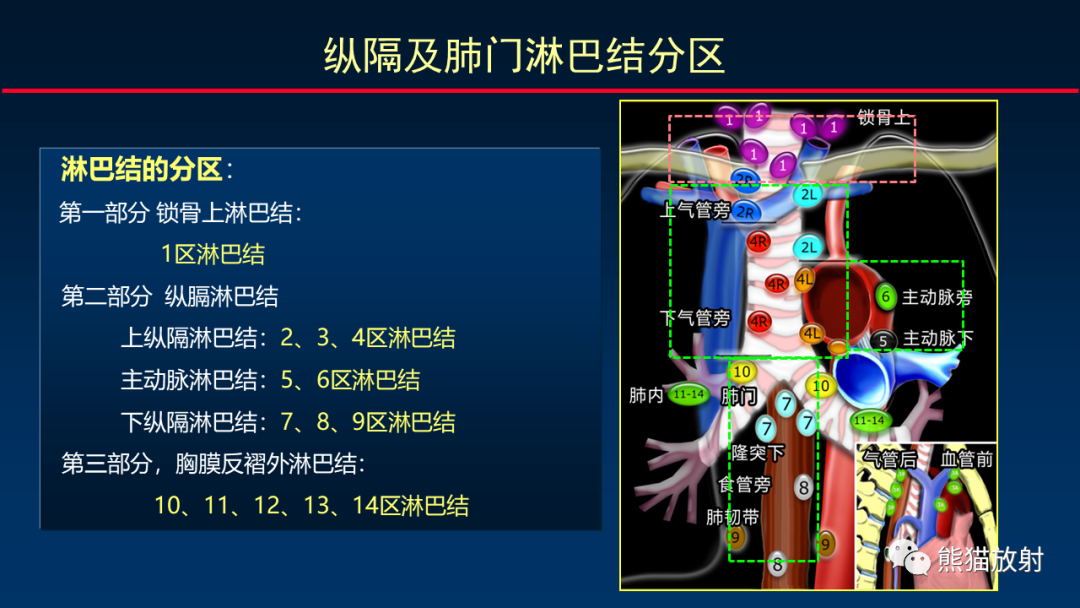 【PPT】纵隔与肺门淋巴结的识别与精准CT分区-13