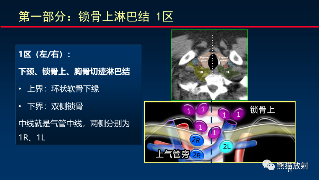 【PPT】纵隔与肺门淋巴结的识别与精准CT分区-14