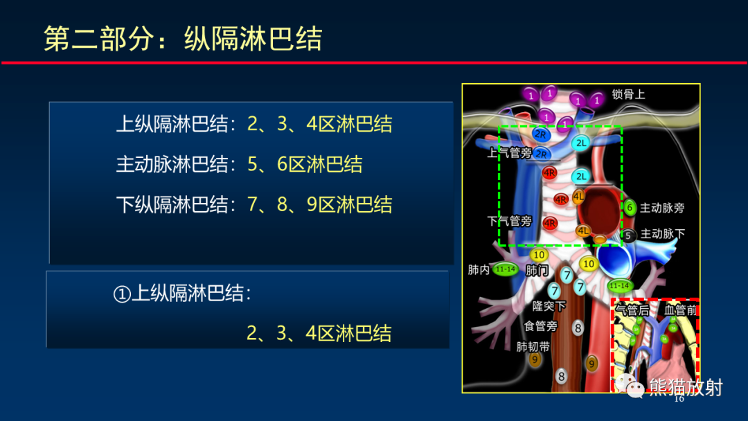 【PPT】纵隔与肺门淋巴结的识别与精准CT分区-16