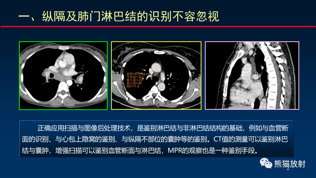 【PPT】纵隔与肺门淋巴结的识别与精准CT分区-2