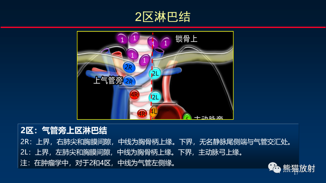 【PPT】纵隔与肺门淋巴结的识别与精准CT分区-17