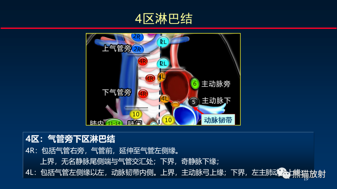 【PPT】纵隔与肺门淋巴结的识别与精准CT分区-19