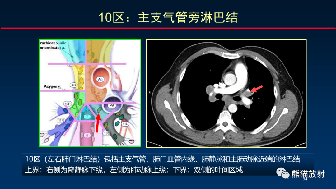 【PPT】纵隔与肺门淋巴结的识别与精准CT分区-54