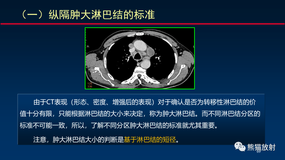 【PPT】纵隔与肺门淋巴结的识别与精准CT分区-69