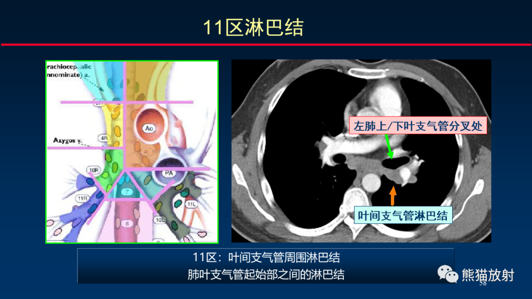 【PPT】纵隔与肺门淋巴结的识别与精准CT分区-58