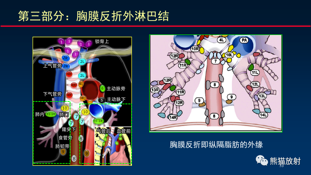 【PPT】纵隔与肺门淋巴结的识别与精准CT分区-53