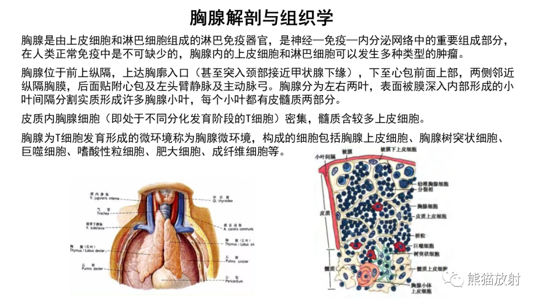 【病例】胸腺神经内分泌肿瘤2例CT影像-18