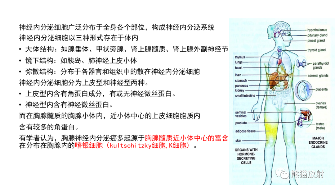 【病例】胸腺神经内分泌肿瘤2例CT影像-19