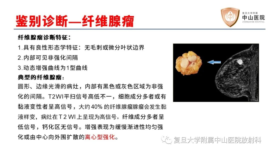 【病例】乳腺粘液腺癌1例MR影像-21