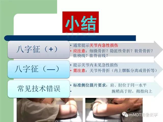 【PPT】儿童肘关节骨折的X线诊断