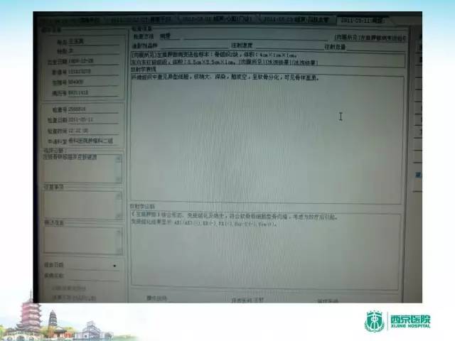 【PPT】骨肉瘤的影像诊断