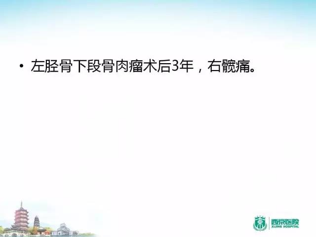 【PPT】骨肉瘤的影像诊断