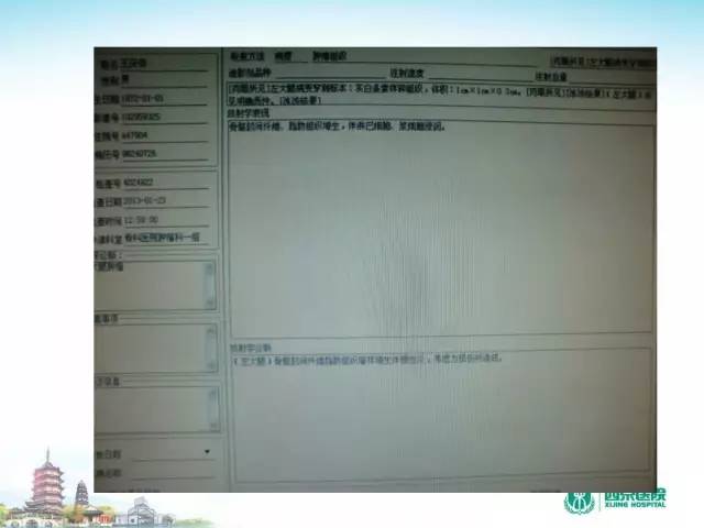 【PPT】骨肉瘤的影像诊断