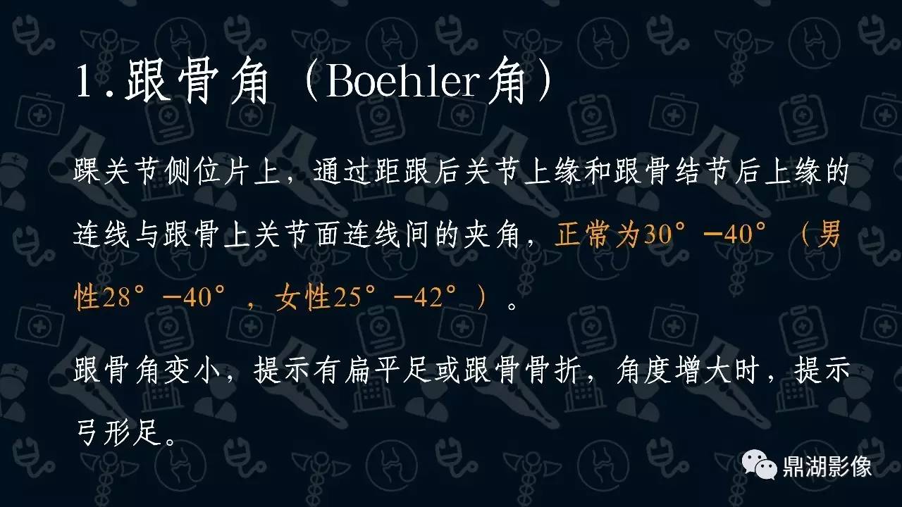 【PPT】扁平足X线测量