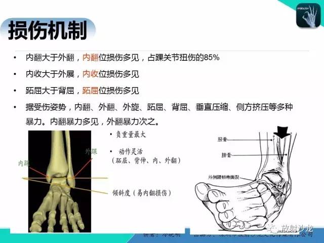 【PPT】基于损伤机制的踝关节急性损伤的影像学评估