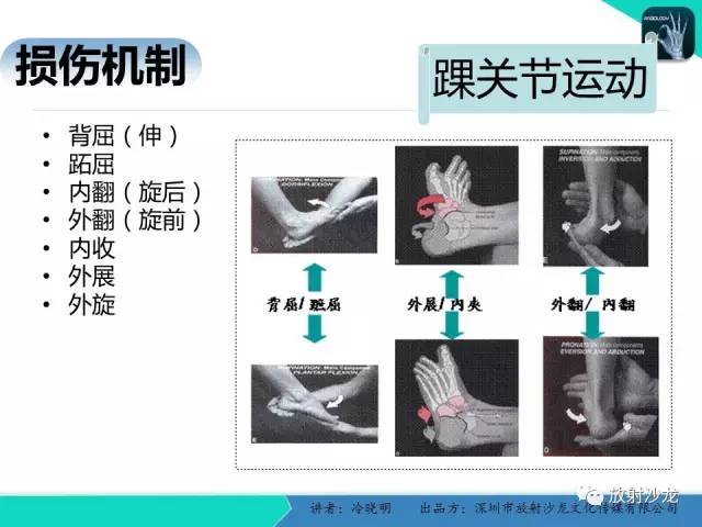 【PPT】基于损伤机制的踝关节急性损伤的影像学评估