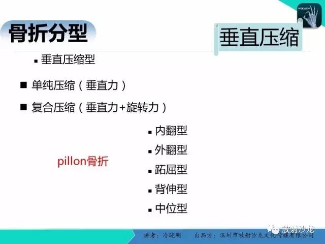 【PPT】基于损伤机制的踝关节急性损伤的影像学评估